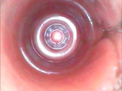 Galeria de fotos de endoscópio - inserção retal masculina